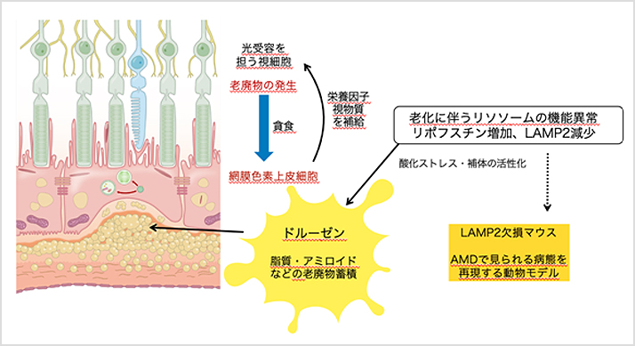 【図1】AMD病態におけるLAMP2およびリソソームの役割