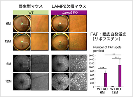 【図2】LAMP2 KOマウスの眼底にリポフスチン顆粒蓄積による著明な自発蛍光の増加を認める