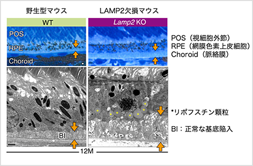 【図3】LAMP2 KOマウスの網膜標本ではRPEの基底膜側にドルーゼン様の沈着物の蓄積を認める。野生型マウスでは正常な基底陥入の構造が見られるのみで、そのような沈着物は全く認めない（矢印）